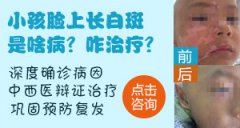 <b>小孩脸上长白斑的原因和治疗分别是啥？</b>