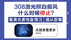 <b>如何治疗成人白癜风比较好呢？</b>